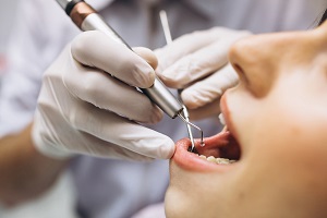 10% of people without access to dental care in 2024
